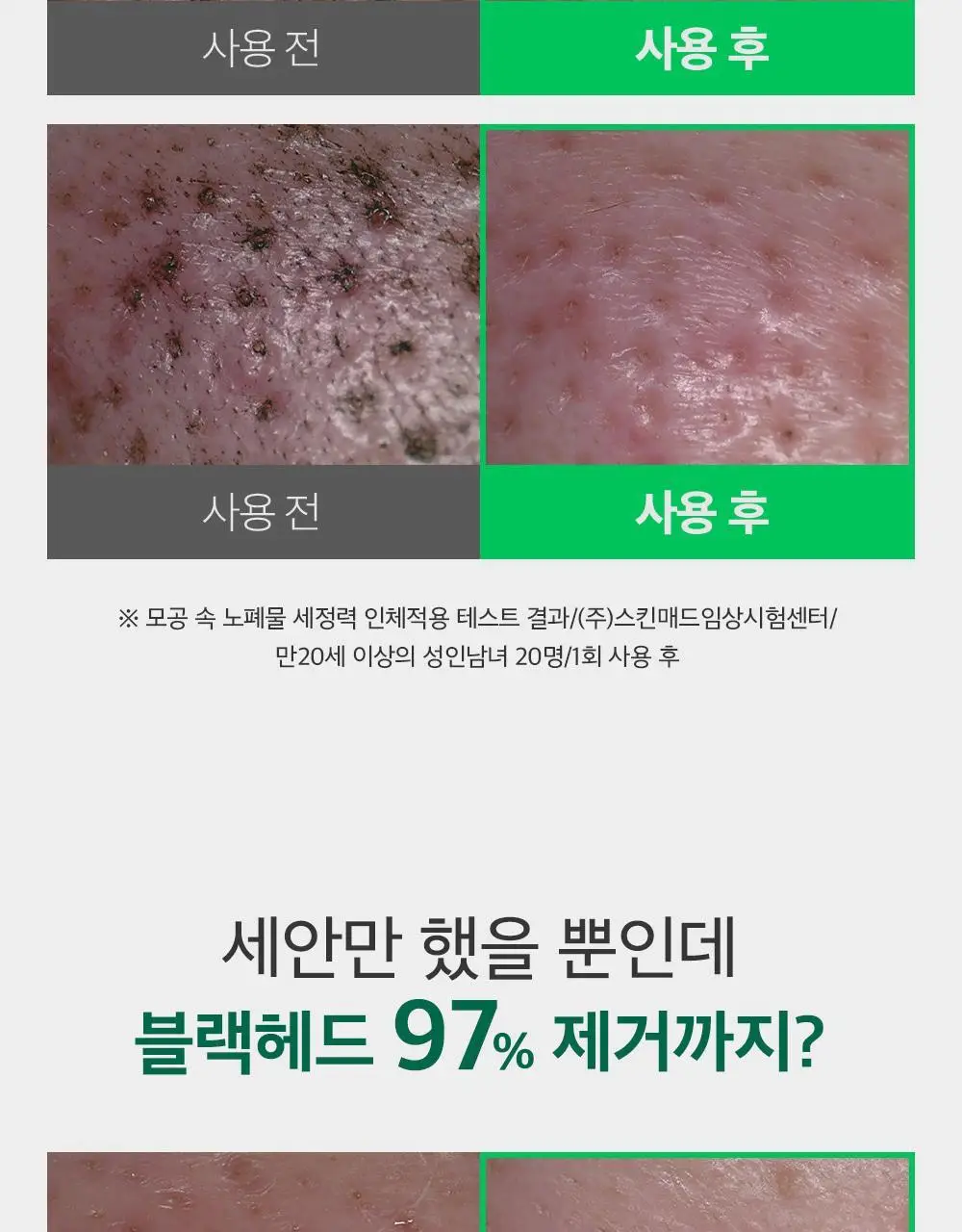 [말끔모공/블랙헤드] 성분에디터 그린토마토 모공 클렌징 오일 200ml 상세페이지 37